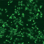 Human squamous epithelial carcinoma cells